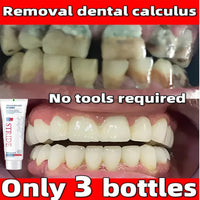 Dental Tartar Removal Toothpaste Anti-Bad Breath Prevention Periodontitis Anti-Yellow Whitening Mouth Fresh Care Products