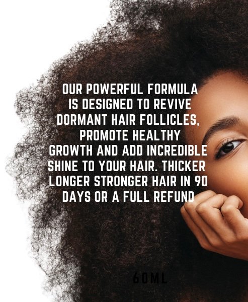 Chloe's Mega Growth Hair Oil - Revive Dormant Hair Follicles, Promote Healthy Growth, and Add Incredible Shine - SAKLIC